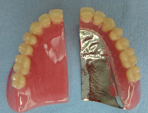 床義歯